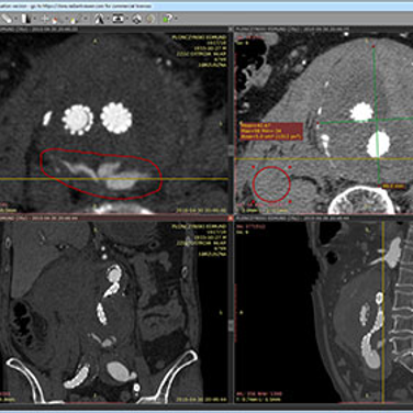 Radiant Dicom Viewer Alternatives And Similar Software Alternativeto Net