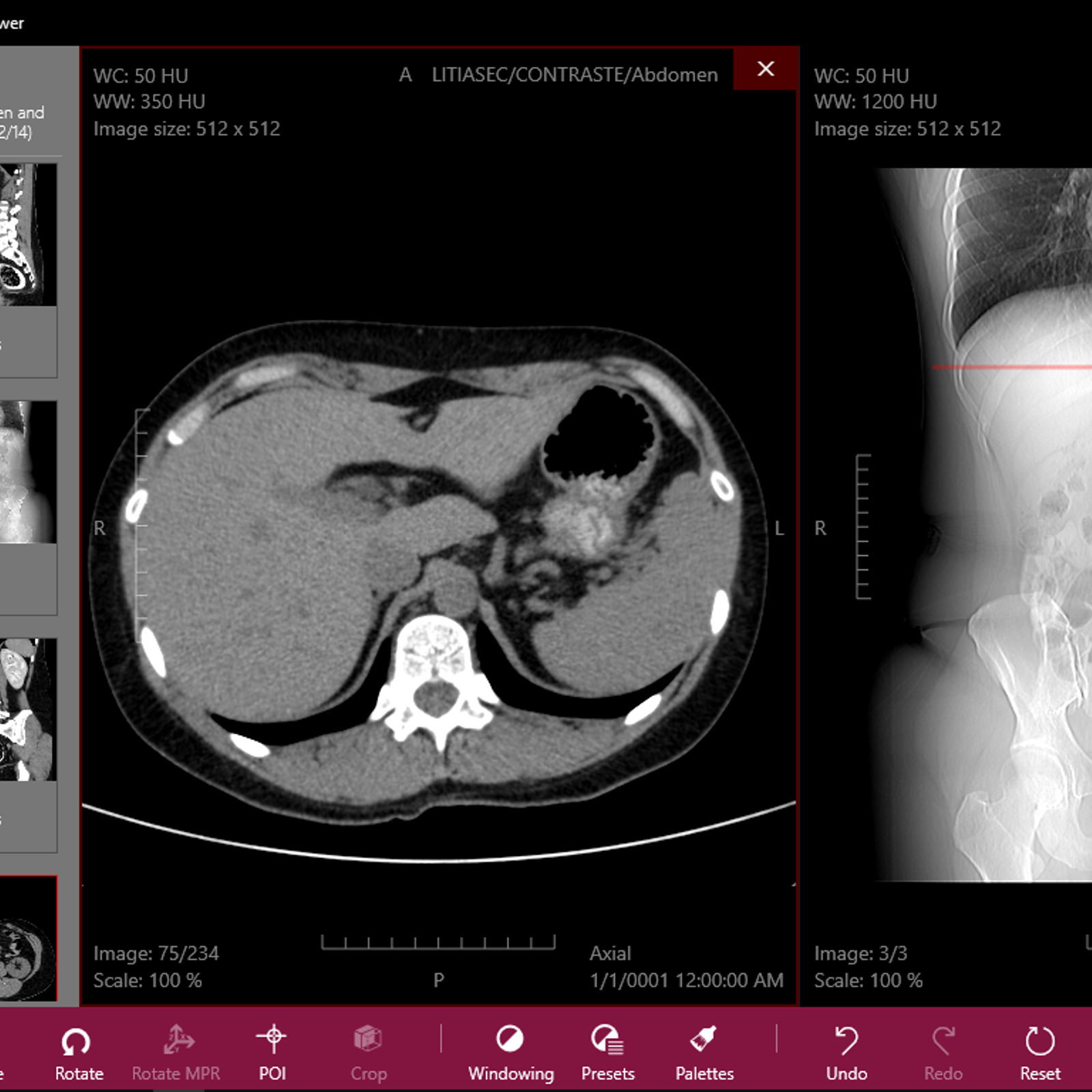 Dicom Viewer Dicom Viewer